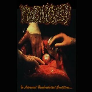 Rotten Wounds Filled With Mealworms - Proctologist Last.fm