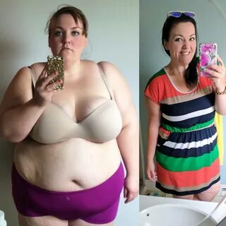 Mallory Buettner Lost 210 Pounds After Weight Loss Surgery T