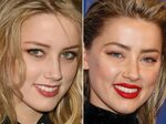 Amber Heard, Before and After Botox, Amber heard, Natural da