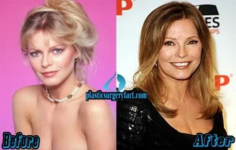 Cheryl Ladd Plastic Surgery Before and After Photos Plastic 