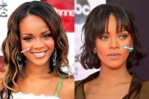 Rihanna Plastic Surgery - Celebrities plastic surgery