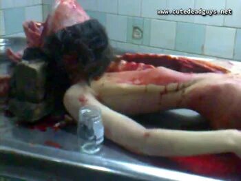 New female autopsy video: Beautiful young dead girl cut up i