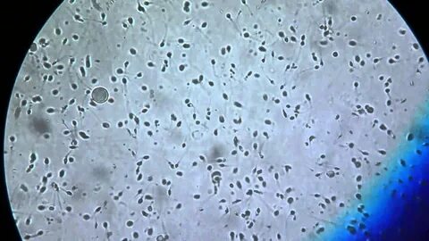 Amoeba Under Microscope 40X / Dinoflagellates - Learn vocabu