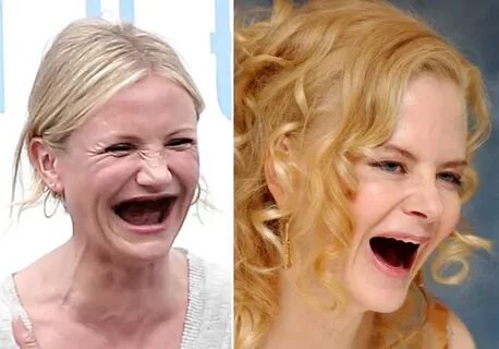 Meme Alert: Celebrities Without Teeth - Oh No They Didn't! -