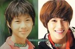 Taemin SHINee Plastic Surgery Before and After Picture