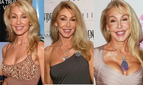 Linda Kozlowski Plastic Surgery Discover More Posts About Li