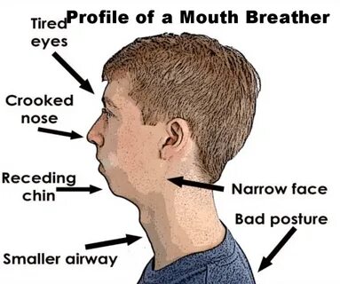How Mouth Breathing Affects Face
