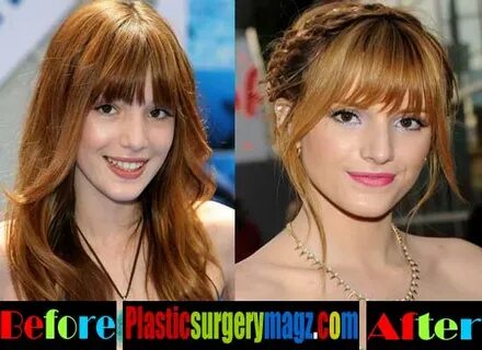 Bella Thorne Plastic Surgery Breast Before and After Plastic