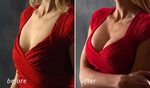 400 breast cc implant - Breast Implant Sizes Photos " Breast