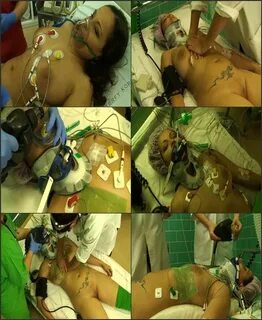 Intubation Porn Sex Pictures Pass