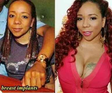 Tameka Cottle Plastic Surgery Before and After - Plastic Sur