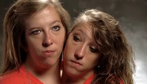 Conjoined Twins Abby And Brittany Porn