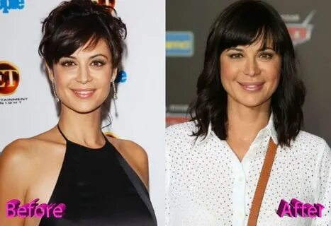 Catherine Bell Before and After Cosmetic Surgery Catherine b