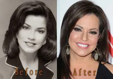 Robin Meade Plastic Surgery - Top Celebrity Surgery