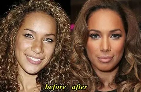 Leona Lewis Plastic Surgery - Plastic Industry In The World