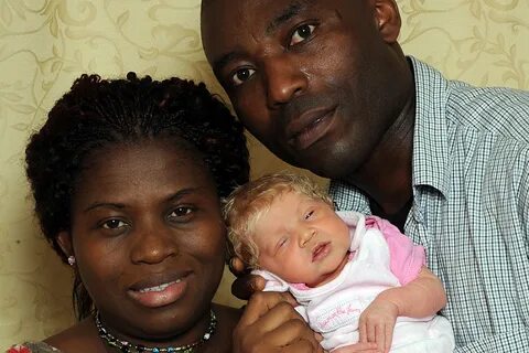 Black parents give birth to white baby