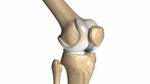 Huesos en la Rodilla Cirugía de Rodilla Extremo Inferior del