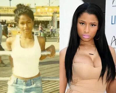 Nicki Minaj Pictures Before Plastic Surgery gallery