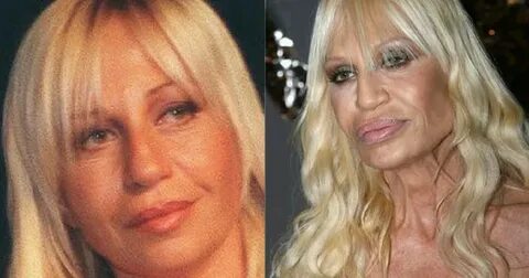 Donatella Versace - Google Search Bad plastic surgeries, Pla