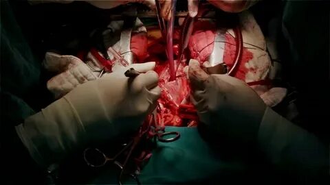 Heart Surgery Concept Сток видео - iStock