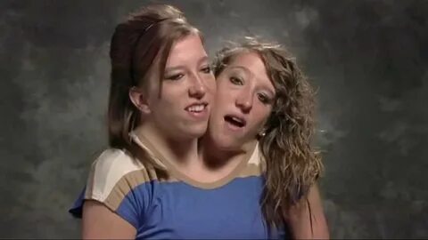 Abigail And Brittany Hensel Porn - Free porn categories watc