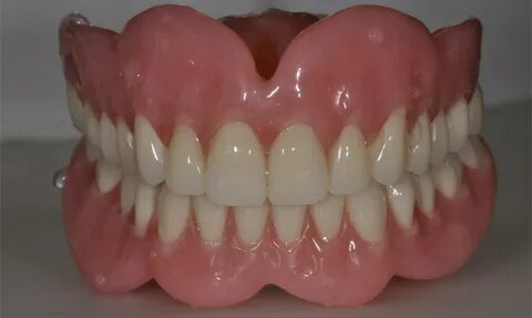 Dentures Buffalo NY Permanent Dentures Southtowns Dental Ser