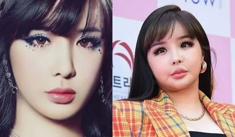 Park Bom biography: Age, net worth, weight gain, plastic sur