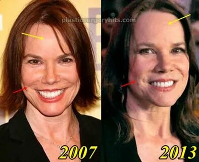 Barbara Hershey Plastic Surgery Before and After - Plastic S
