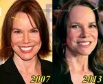 Barbara Hershey Plastic Surgery Before and After - Plastic S