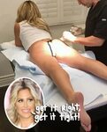 Kim Zolciak Gets 'Cellulite Dimples' Injected With Filler - 