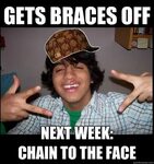 Funny braces Memes