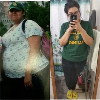 Lost 115 lbs. Can now walk up a flight of stairs without com