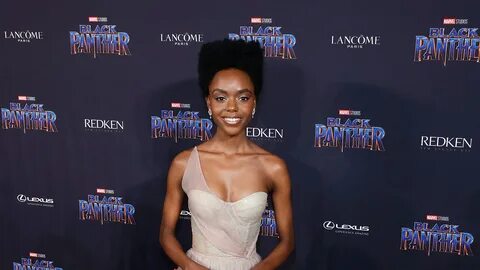 How Riverdale Actress Ashleigh Murray Deals With Her Cystic 