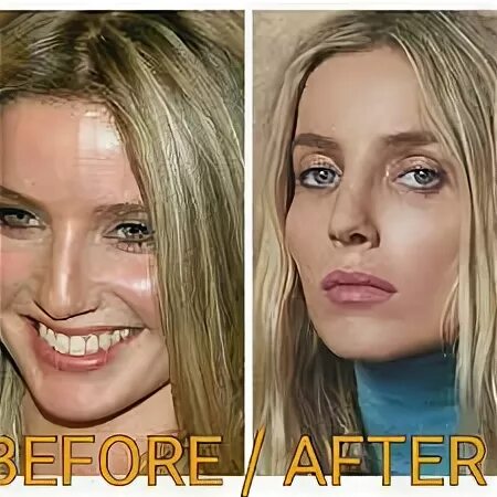 Annabelle Wallis’s Before And After Nose Job Pictures - Cele