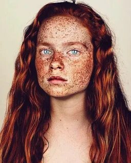 Pin by Emily Butz on Веснушки そ ば か す Freckles Beautiful fre