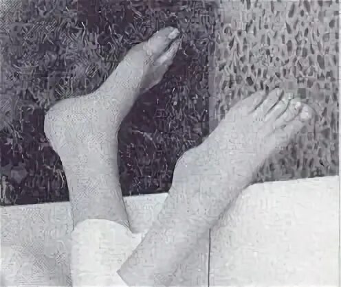 Did Marilyn Monroe Have Six Toes? Snopes.com