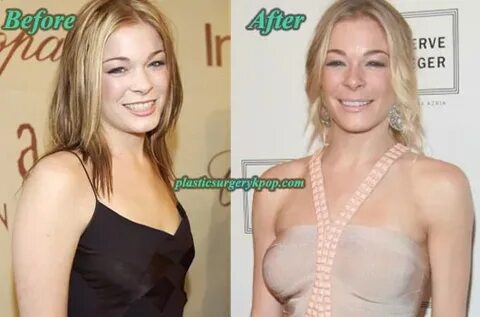 LeAnn Rimes Plastic Surgery Boobs Job Before and After Pictu