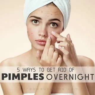 5 Ways to Get Rid of Pimples Overnight Pimples overnight, Ho