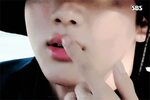 Mosquitos attacked Jin's lips ARMY's Amino