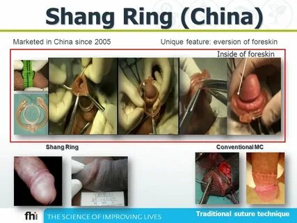 Put a Ring on it: How the Shang Ring Might Accelerate MC Pro