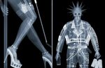 Fun with X-Rays - machinations of an x-ray technician Xray a