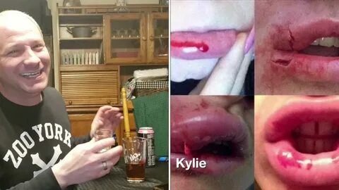 THE KYLIE JENNER LIP CHALLENGE - YouTube