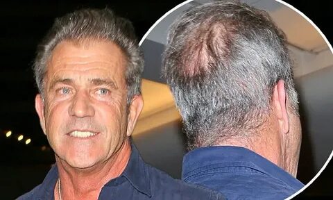 Mel Gibson displays thinning hair and bald spot as he jets o