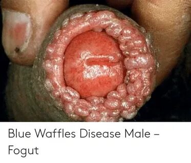 Blue Waffles Disease Male - Fogut Blue Meme on awwmemes.com