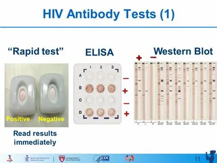 1 Counseling and HIV Testing HAIVN Harvard Medical School AI