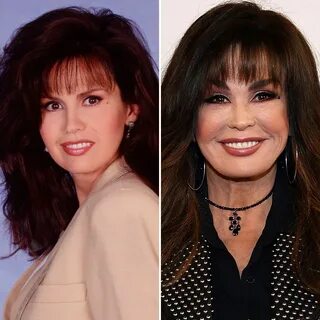 Has Marie Osmond Gotten Plastic Surgery? Our Experts Weigh I