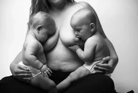 Η ομορφιά του γυναικείου σώματος μετά τη γέννα! - babyradio.