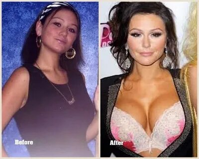 Jwoww Before And After Plastic Surgery : 'Jersey Shore' Cast