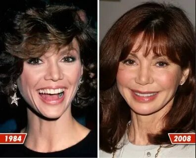 Victoria Principal then and now Celebrity plastic surgery, V