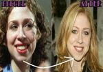 Chelsea Clinton plastic surgery - Define NetWorth